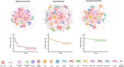 Cellular collusion: cracking the code of immunosuppression and chemo resistance in PDAC